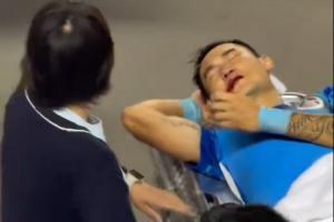 财盛证券 新鹏城官方：廖力生鼻骨粉碎性骨折，已完成鼻骨骨折复位术出院